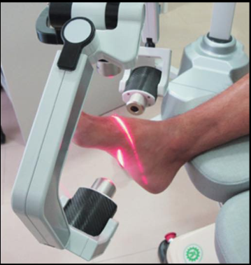 Лазер красной линии для облегчения боли 